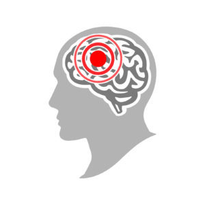 Headache And Migraine Concept. Silhouette Of A Human Head With A
