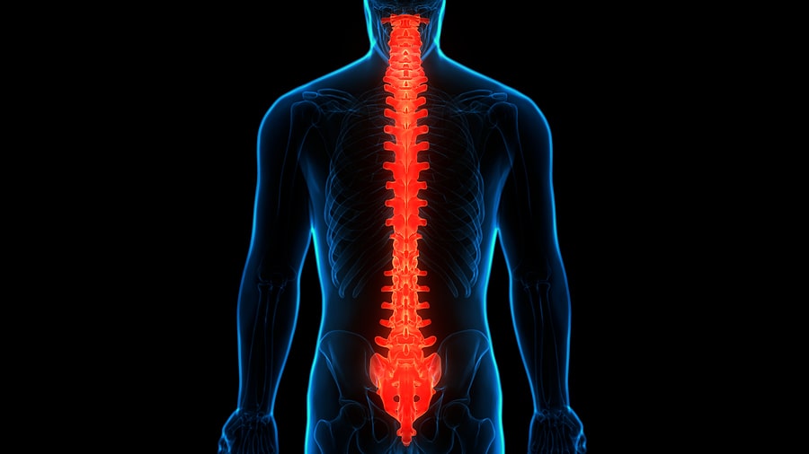 El Centro Spinal Cord Injury Lawyer
